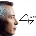 Empresa de Elon Musk anuncia primeiro implante de chip cerebral em humano